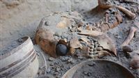 World oldest prosthetic eye found in Iran